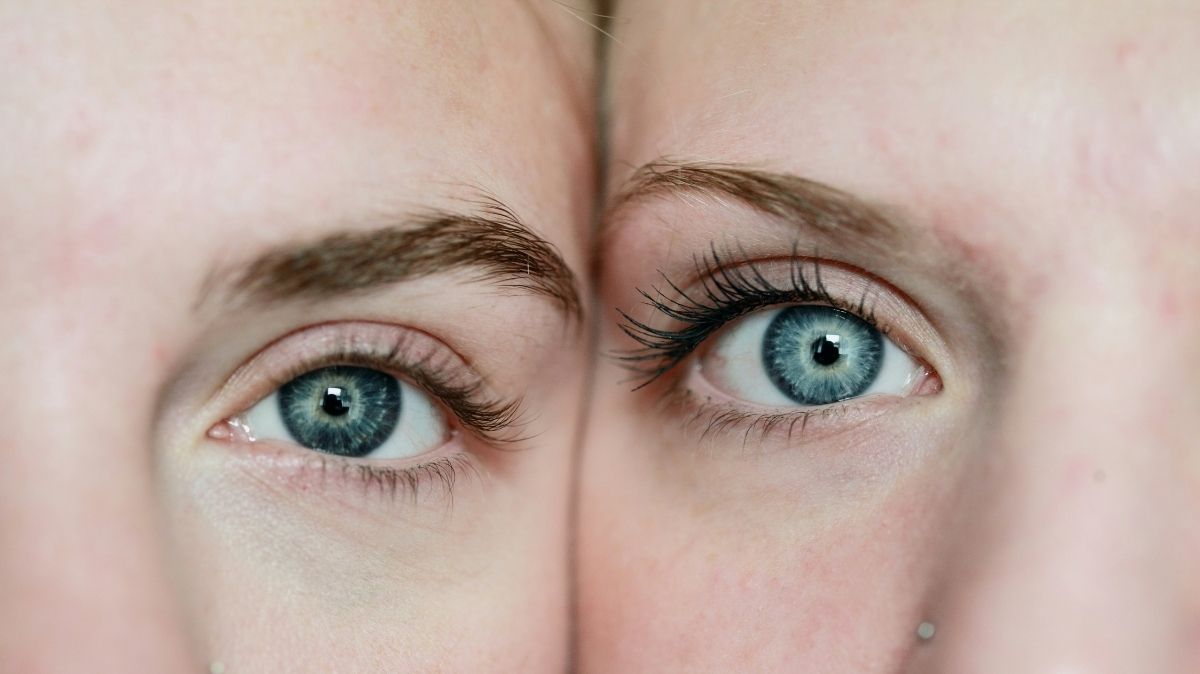 Chin Filler Before and After: 5 Amazing Results You’ll Love