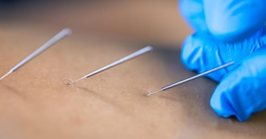 Everything You Need to Know About Piercing Needles